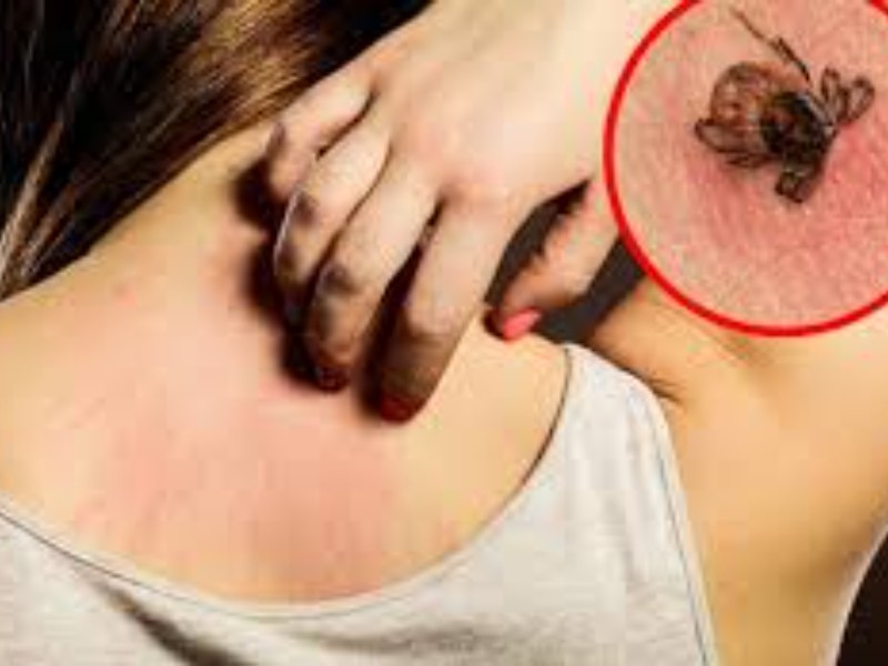 Suman 77 casos de rickettsiosis en Sonora