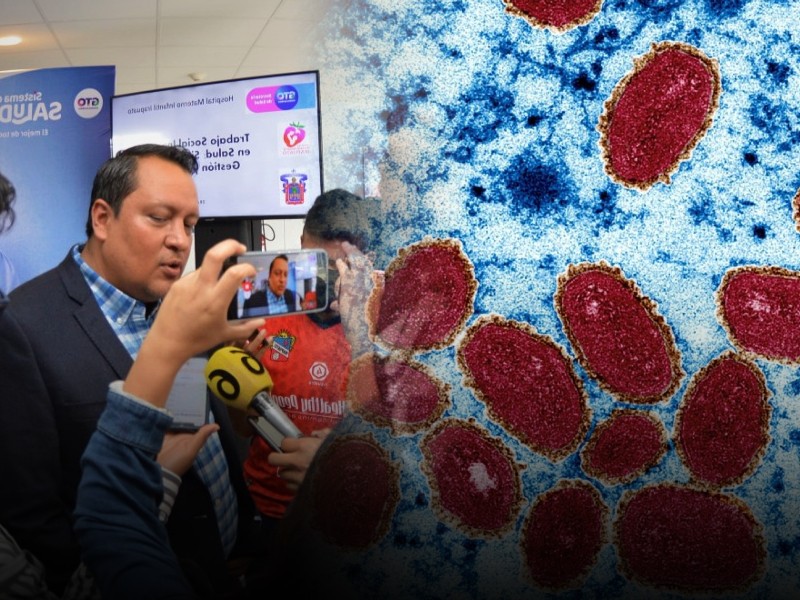 SSG confirma segundo caso de viruela simica en Guanajuato