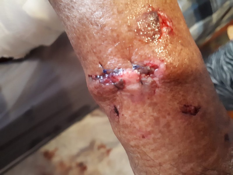 Sufre el atleta Miguel Cano brutal ataque por un perro