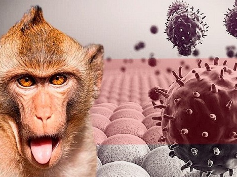 Van 91 casos de viruela del mono en México