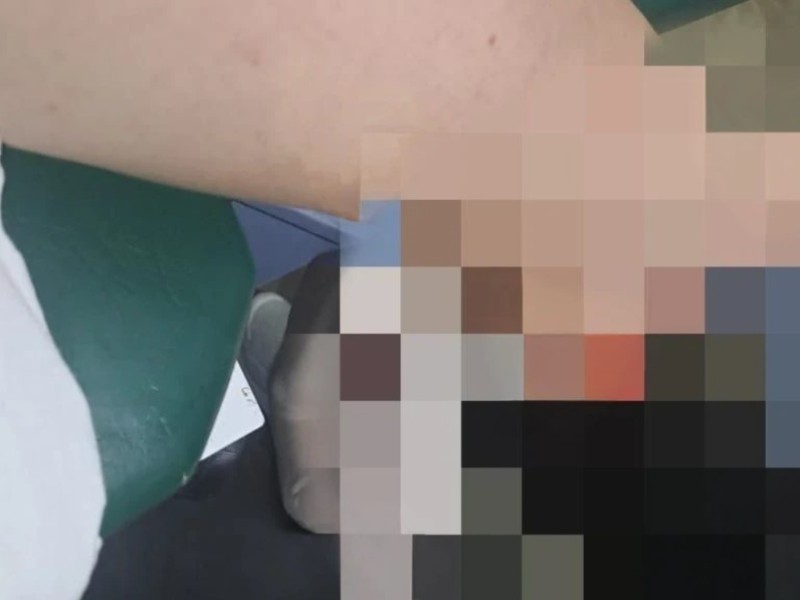 Vecinos de Tehuantepec exigen control ante ataques de perros agresivos