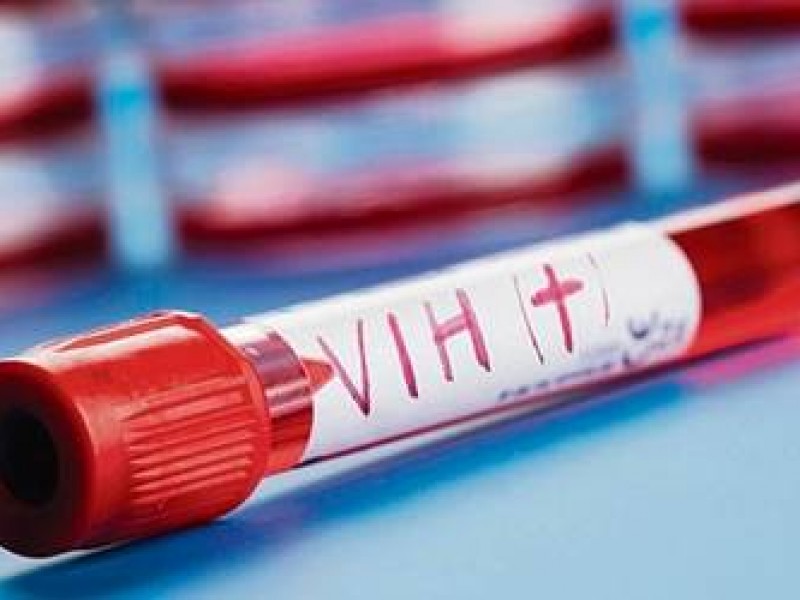 Veracruz encabeza muerte materna con VIH-SIDA