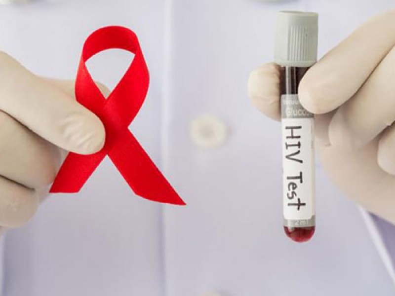 Veracruz primer lugar con más muertes por SIDA