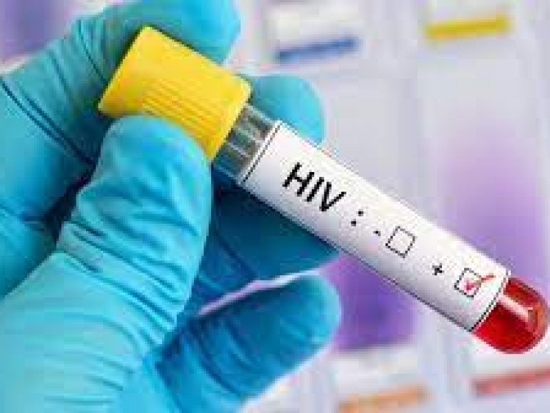 Veracruz tercer lugar a nivel nacional en casos de VIH-SIDA