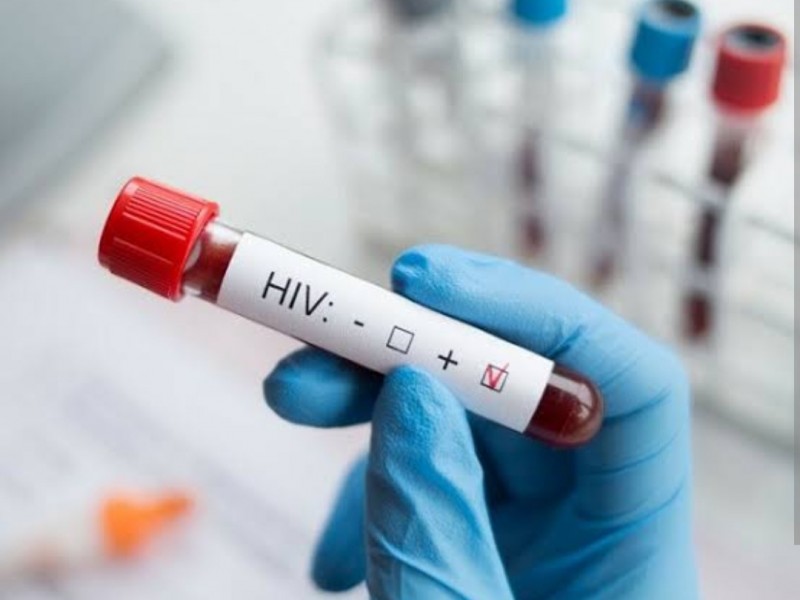 Veracruz tercer lugar en casos de VIH