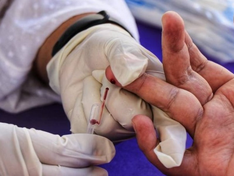 VIH SIDA una pandemia que no se ha podido controlar